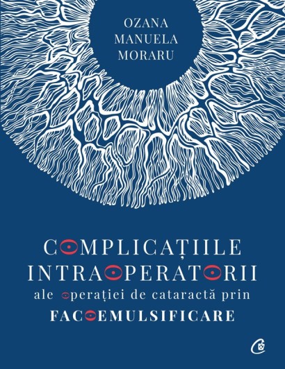Complicațiile intraoperatorii ale operatiei de cataractă prin facoemulsificare